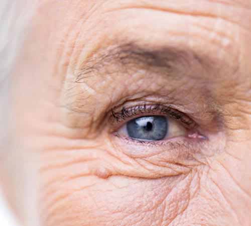 Eyelid Growths & Tumors